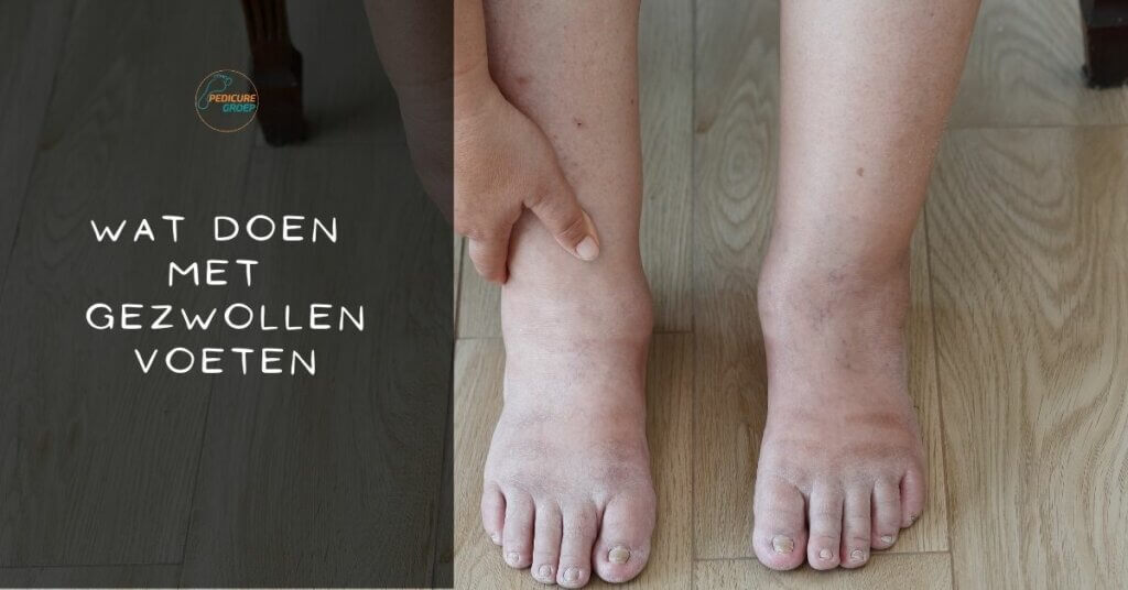 Tintelingen in de voeten PODO+